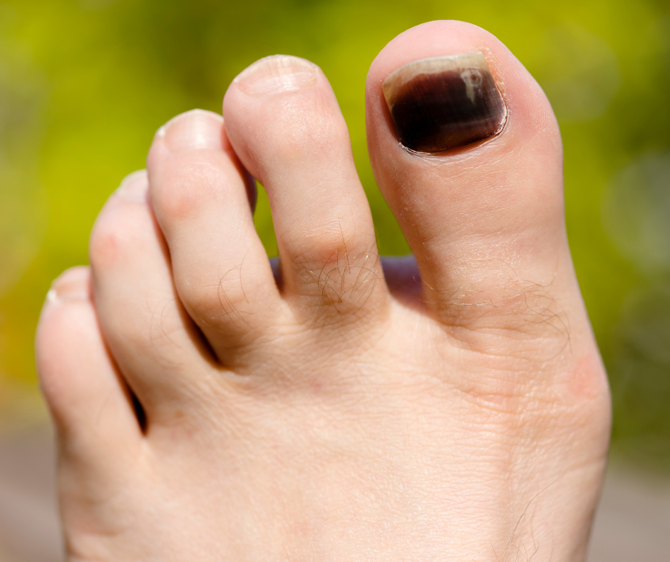 10 Expert Tips For Perfect Toenail Health Now