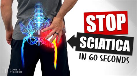 2. 10 Powerful Ways To Walk Off Sciatica Pain Today