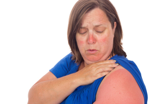 2. Pro Tips: Recognize 10 Early Symptoms Of Sun Poisoning Today