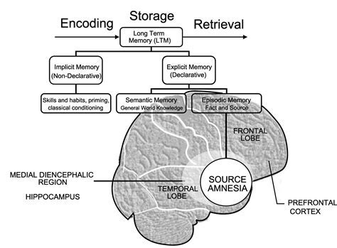 7 Expert Ways To Overcome Source Amnesia Now