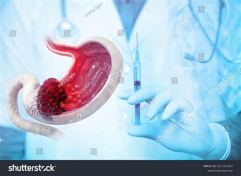 942 Stomach Doctor Dna Shutterstock