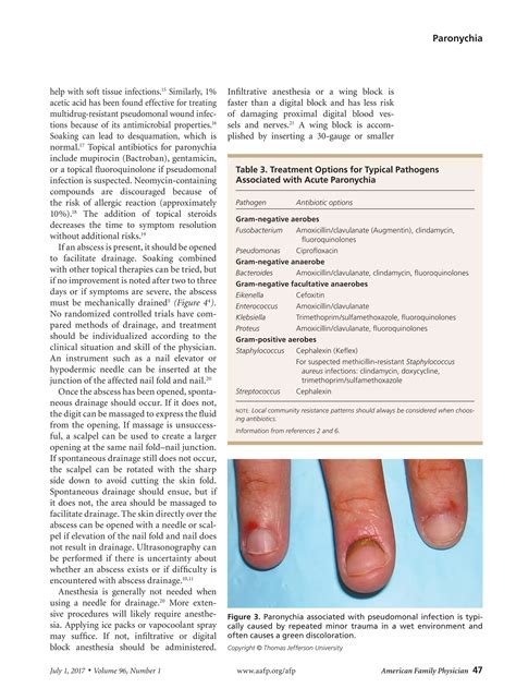 Acute And Chronic Paronychia Aafp