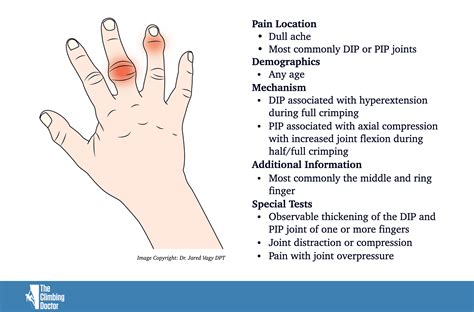 Capsulitis And Synovitis Climbing Swelling Of The Fingers The