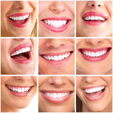 Create A Dazzling Smile With Cosmetic Dentistry Donald Marks Family