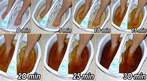 Detox Foot Spa Ionic Detoxification To Cleanse Remove Toxins