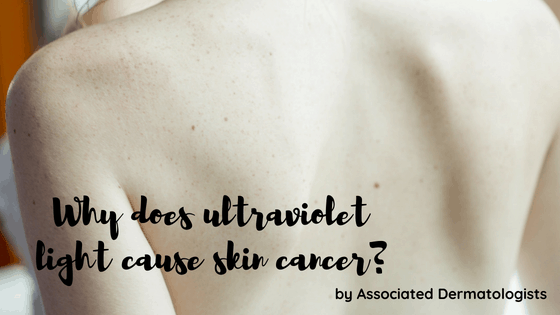 Does Ultraviolet Light Cause Cancer