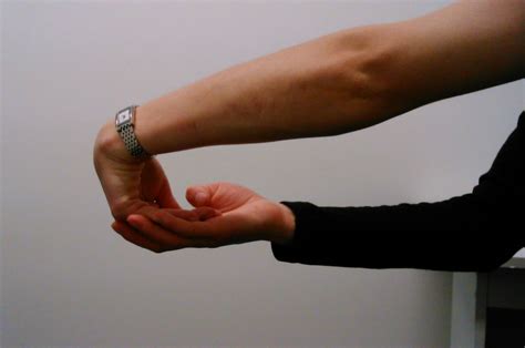 Elbow Pain A Physios Exercises Physio Prescription