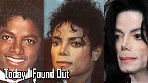 How Did Michael Jackson S Skin Turn White As He Got Older