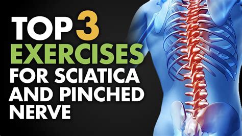 How To Alleviate Sciatica Pain Crazyscreen21