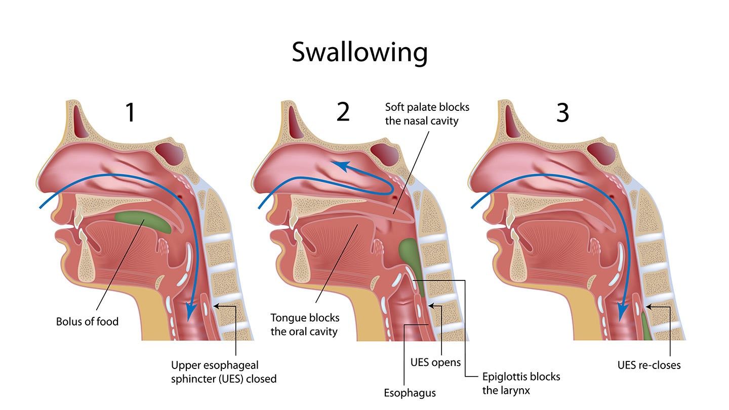 How To Deal With Dysphagia When You Have Ms Everyday Health