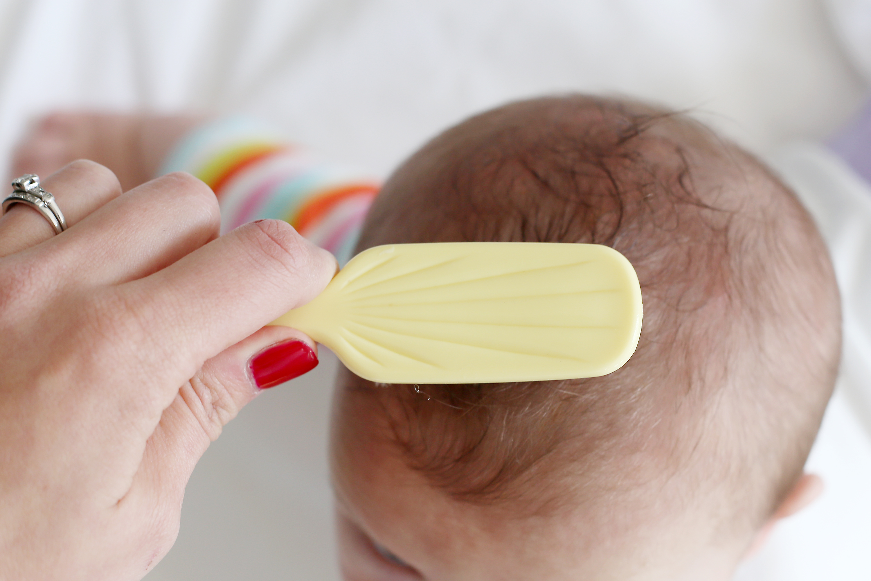 How To Treat Dry Scalp In Babies Livestrong Com