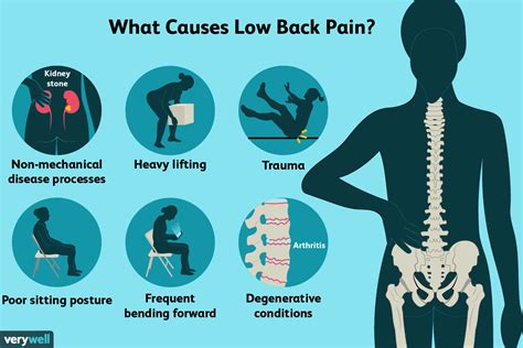 Lower Back Pain 14 Common Causes With Treatment