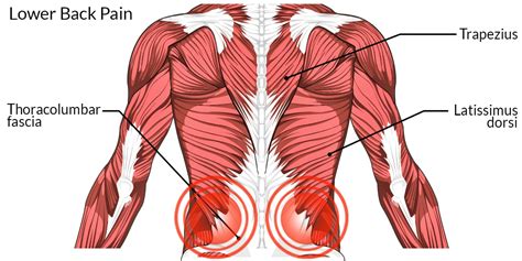 Lower Back Pain The Complete Injury Guide Vive Health