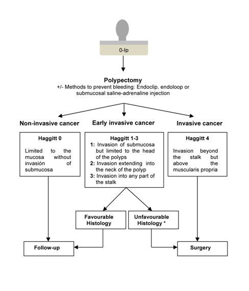 Malignant Colorectal Polyps Diagnosis Treatment And Prognosis