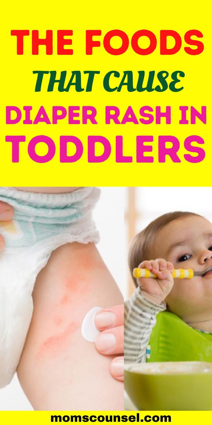 Most Common Foods That Cause Diaper Rash In Toddlers