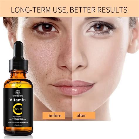 Private Label Skincare Natural 20% Vitamin C Serum Hyaluronic Acid ...