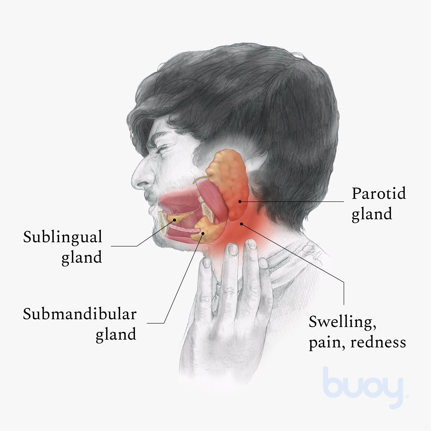 Salivary Gland Cancer Causes Symptoms And Treatment