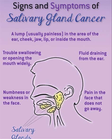 Signs And Symptoms Of A Salivary Gland Tumor Dr Ljubica Bani