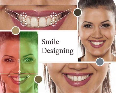 Smile Designing Epic Smiles Dental Hospital