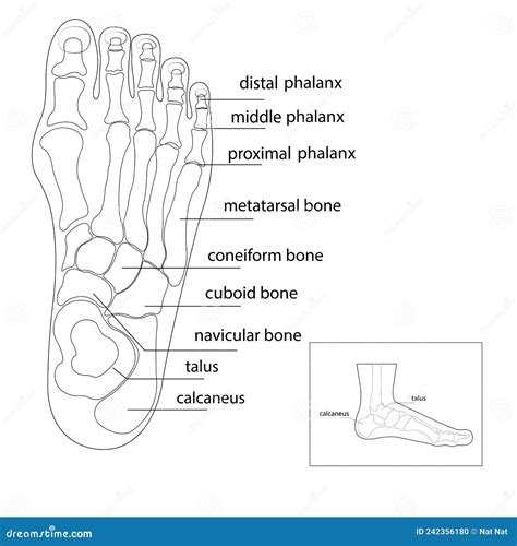 The Bone And Skin On The Sides Of The Big Toe Joint Form An Abnormal