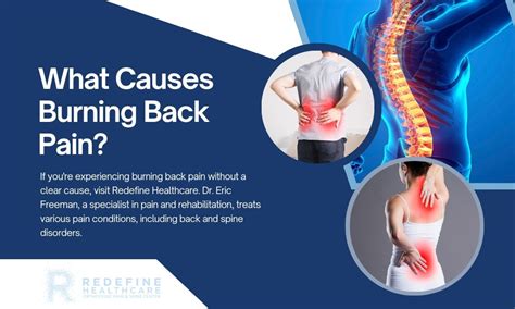 What Causes Burning Back Pain Nj Amp 39 S Top Orthopedic Spine Amp Pain Management Center