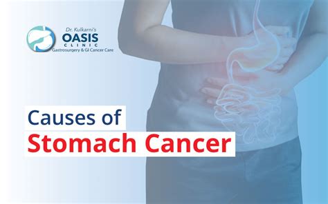 What Causes Stomach Cancer Oasis Clinic