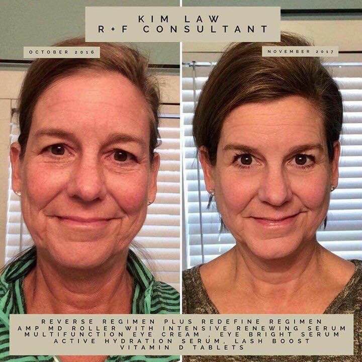 Why Not Age Gracefully Rodanandfields Freegift Aginggracefully